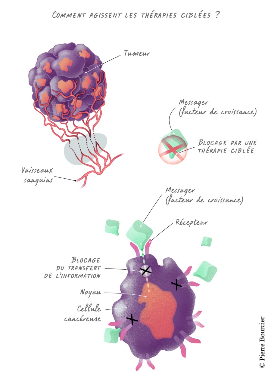 Comment agissent les thérapies ciblées - Illustration de Pierre Bourcier